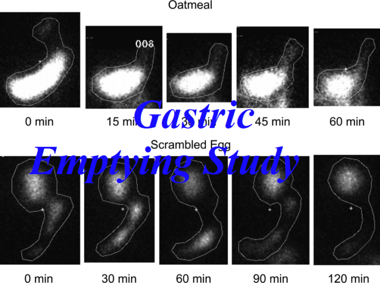 nuclear-medicine-gastric-emptying-study-preparation-archives-health