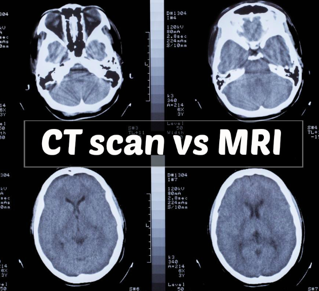 Difference in CT Scan vs MRI