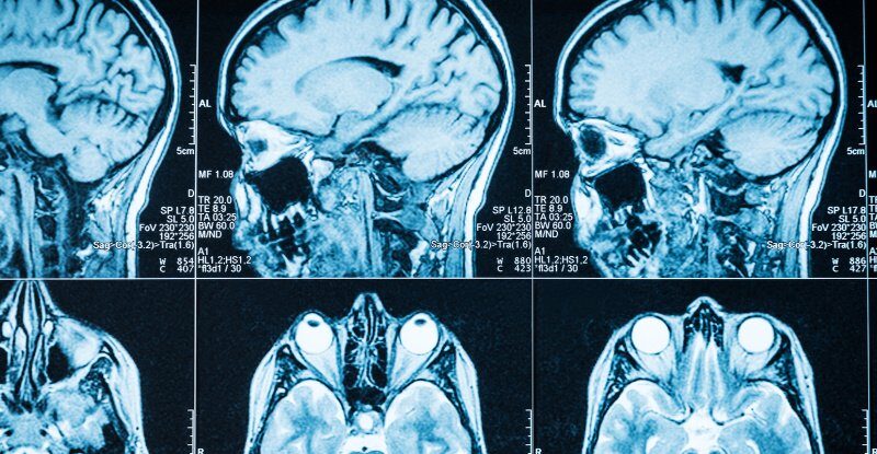 4 Neurological Symptoms You Should Never Choose to Ignore