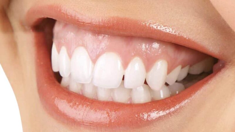 You Are What You Eat: Food for Healthy Teeth and Gums