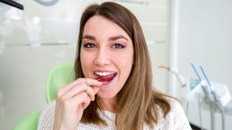 Invisalign Do’s and Don’ts You Need to Know