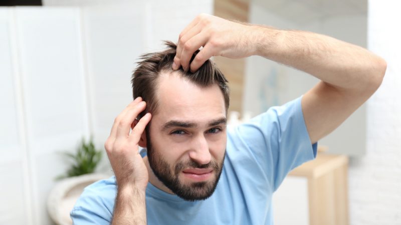 How to prevent and cure hair loss – a complete guide