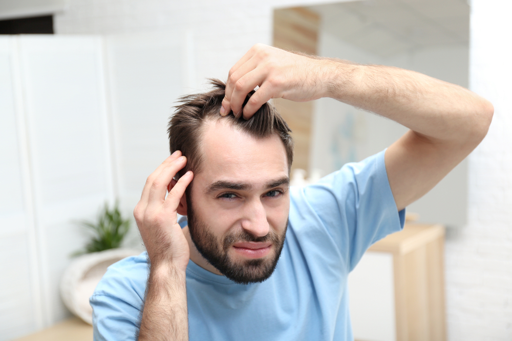 How to prevent and cure hair loss – a complete guide