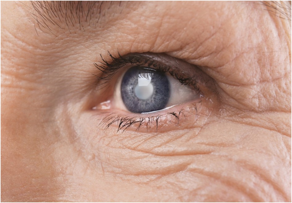 What You Need to Know About Endothelial Keratoplasty: A Brief Guide