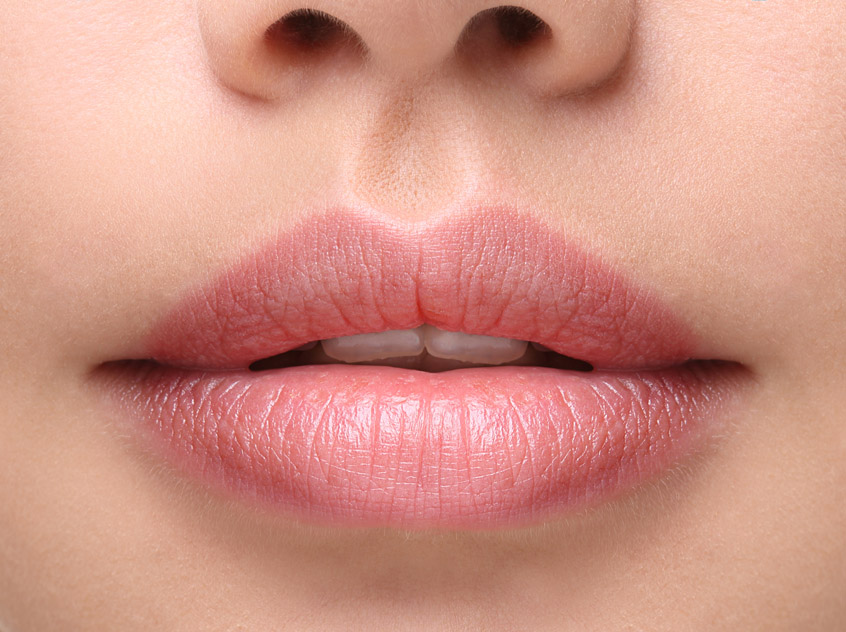 After care tips for lip filler treatment to maintain fuller