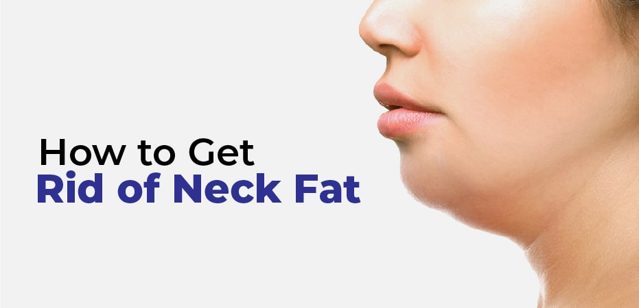 how to get rid of neck fat under chin