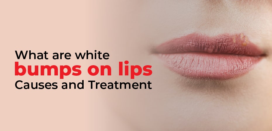 What are white bumps on lips? Causes and Treatment
