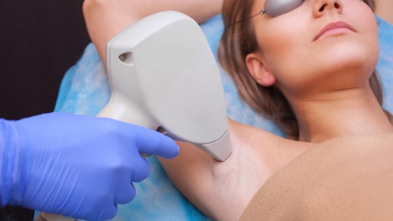 Laser Hair Removal Overview