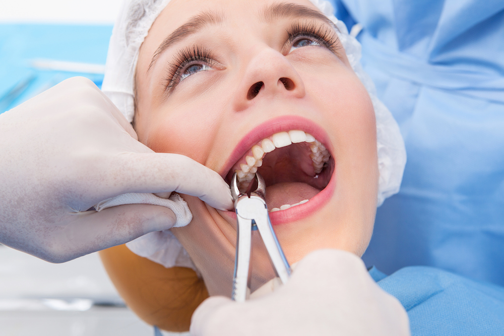 What To Expect When You’re Expecting…a Tooth Extraction