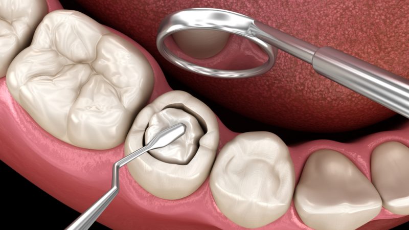 Who Is a Periodontal Surgeon, and Why Do You Need to Visit One Now?
