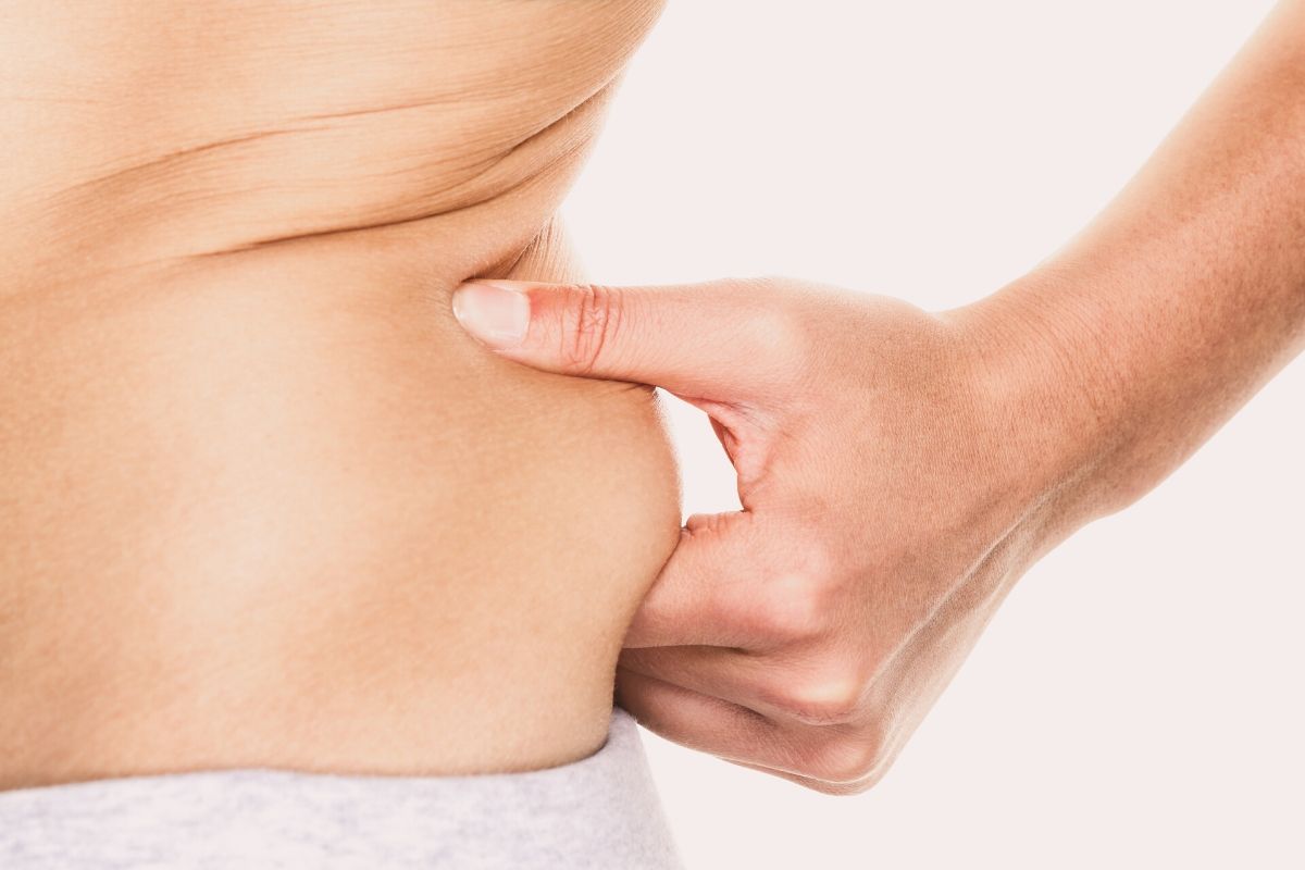 Fat Freezing: Get Rid of the Stubborn Fat Cells Around Your Body